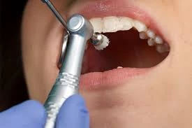 Ambientacion Periodontal
